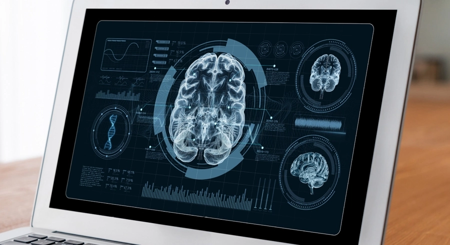 monitor imágenes del cerebro